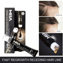Load image into Gallery viewer, Hairline Hair Growth Growth Fluid