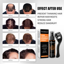 Load image into Gallery viewer, Hair Growth Spray Anti-hair Nourishing Growth Liquid