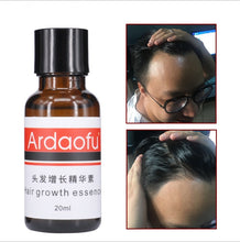 Load image into Gallery viewer, Growth, hair loss, hair growth prevention