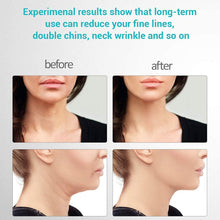 Load image into Gallery viewer, Banloach™ - Skin Rejuvenating Device