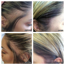 Load image into Gallery viewer, Hairline Hair Growth Growth Fluid
