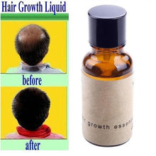 Load image into Gallery viewer, Hair growth liquid
